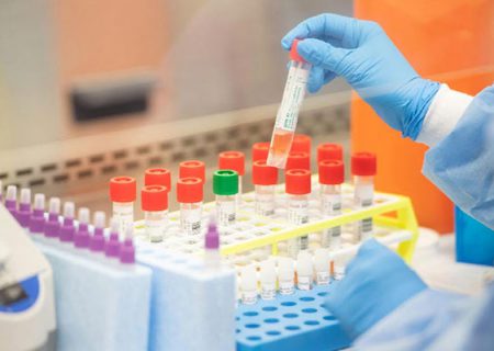 صنعتی سازی کیت های تشخیص سلولی توسط یک شرکت دانش بنیان