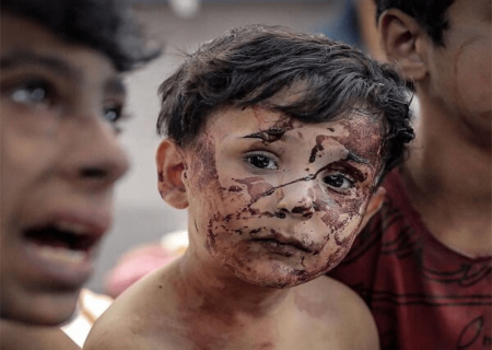 وضعیت کودکان در غزه وحشتناک است